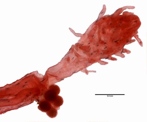 Coryne pusilla