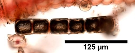 Melosira nummuloides?
