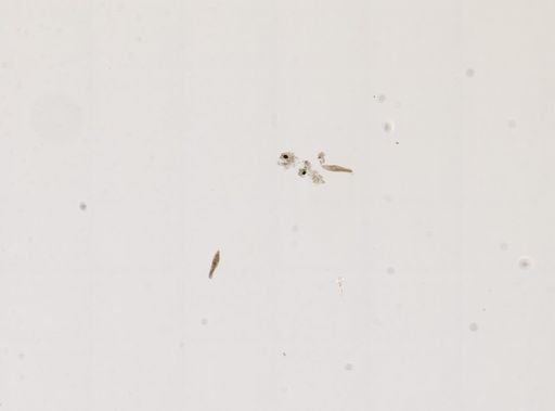 Paramecium