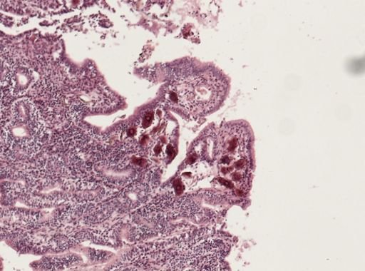 Schistosoma japonicum
