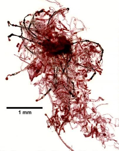 Pedicellina