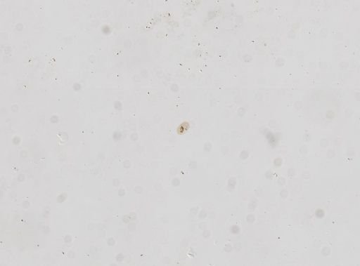 Paramecium polycaryum