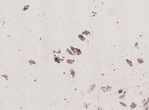 Paramecium caudatum