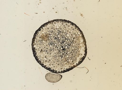 Ascaris