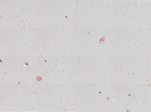 Distomum