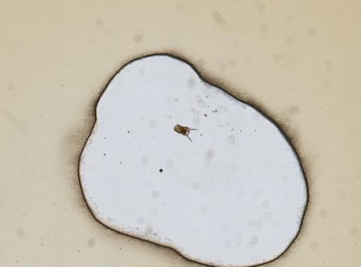Keratella quadrata