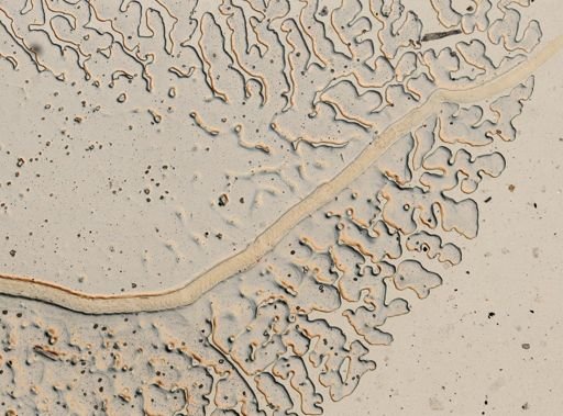 Capillaria feliscati