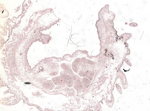 Thysanozoon brocchii