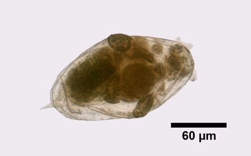 Elosa spinifera