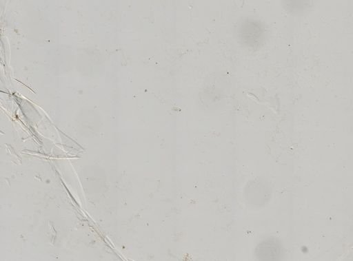 Paramecium