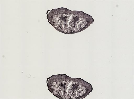 Foviella