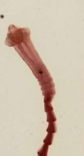 Dipylidium caninum