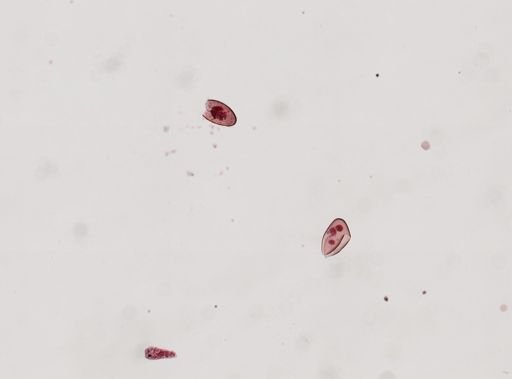 Fasciola hepatica