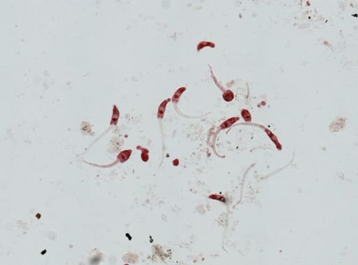 Echinostoma