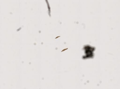Paramecium