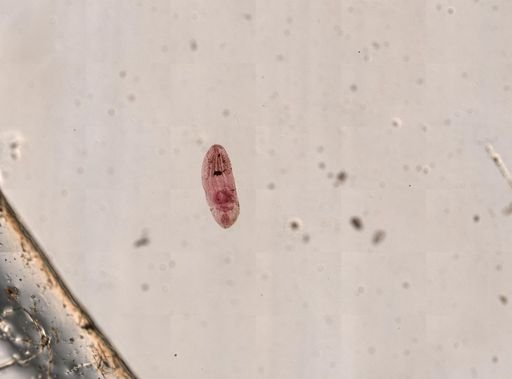 Posthodiplostomum minimum