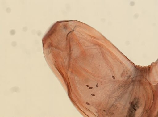 Oligacanthorhynchus microcephalus