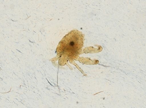 Pthirus pubis