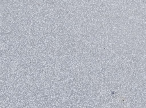 Plasmodium vivax