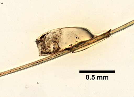 Pediculus humanus