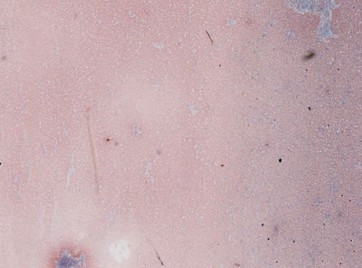Trypanosoma