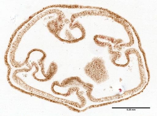 Scyphozoa