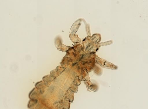 Pediculus humanus