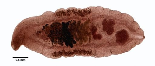 Opisthorchis felineus