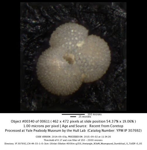 Globigerinoides ruber