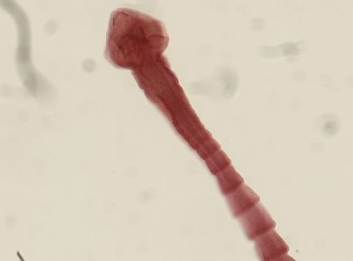 Dipylidium caninum