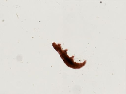 Dactylobiotus