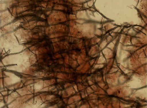 Isodictya deichmannae