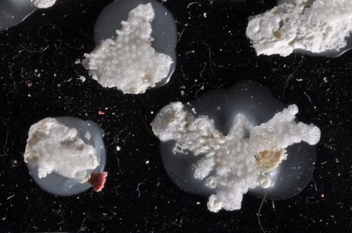 Bryozoa