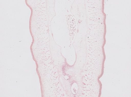 Taenia saginata