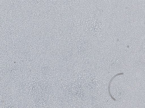 Plasmodium vivax