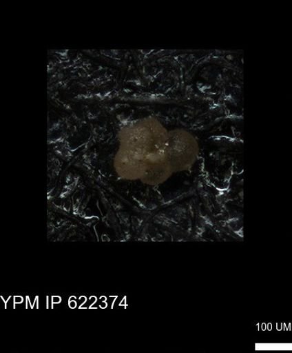 undet. Rugoglobigerinidae