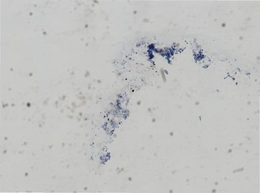 Bacteria