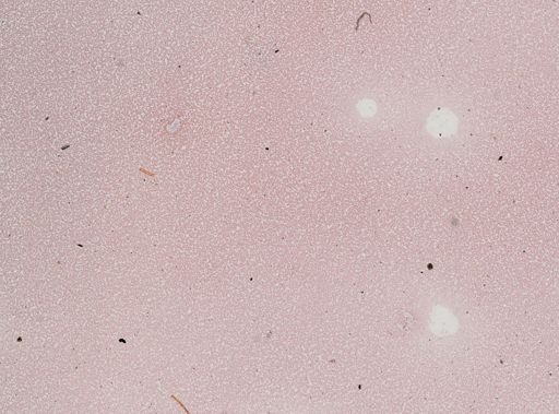 Trypanosoma equinum