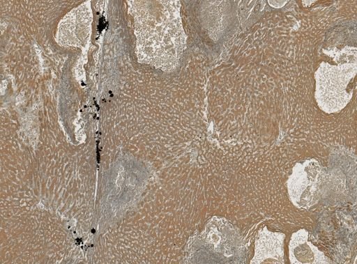 Taenia crassicollis