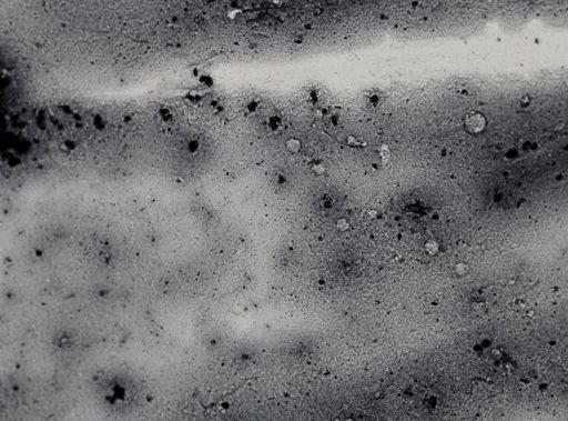 Entamoeba coli