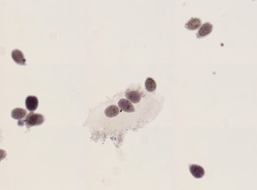 Echinococcus