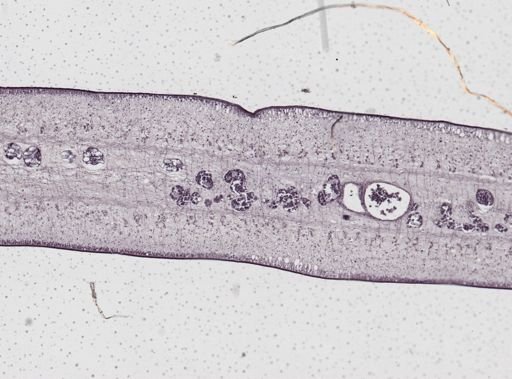 Taenia saginata