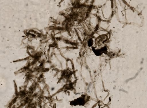 Victorella pavida