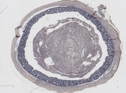 Eimeria meleagrimitis