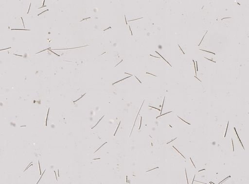 cf. Endectyon (Hemectyon)