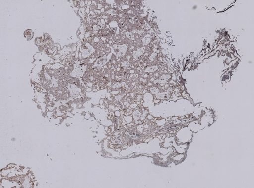 Stromatospongia vermicola