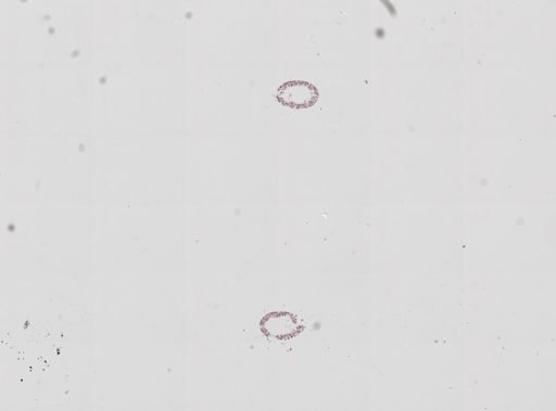 Hydra
