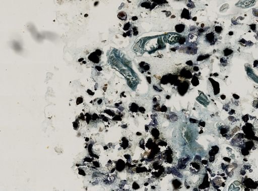 Ascidiacea