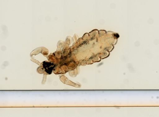 Pediculus humanus