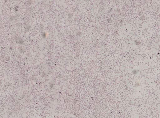 Trypanosoma?